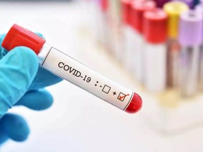 This subvariant of the Covid-19 virus has been detected five times so far in Moscow