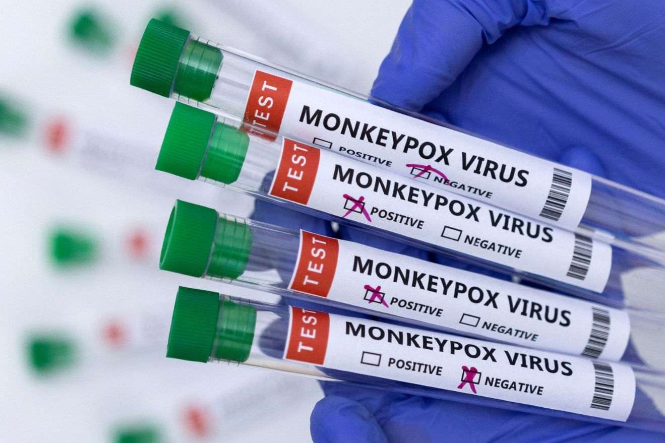 The Doctors Were Misled About the Type of Monkeypox They Were Treating